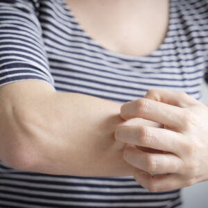 Кои витамини ни липсват, ако кожата ни се бели?