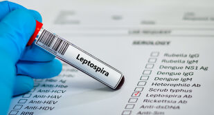 Случаи на заразени с лептоспироза на остров Закинтос, мъж е починал