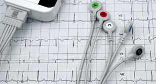 Защо случаите на инфаркт и инсулт се увеличават между Коледа и Нова година?