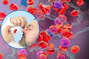 Защо хемофилията засяга повече мъжете и кога става животозастрашаваща