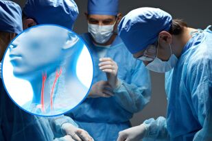 Как се отпушва запушена сънна артерия