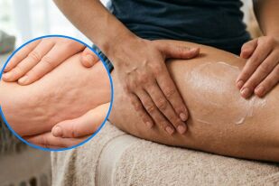 Работят ли антицелулитните кремове и продуктите за изгаряне на мазнини?