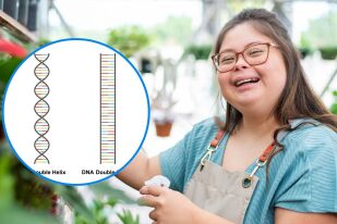 Опитват да премахнат най-важната причина за Синдрома на Даун