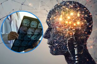 Симптоми на глиобластом: Как да разпознаем ранните признаци навреме?