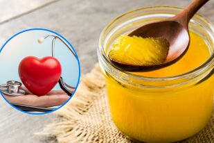 Маслото гхи: Ползи и вреди и как да си го направите вкъщи (РЕЦЕПТА)