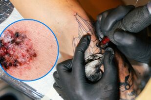 Могат ли татуировките да са причина за рак? 