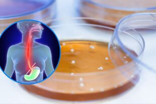  Как бактерията Lactobacillus може да предотврати рака