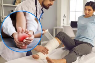 Стрес фрактура: Симптоми и как да я лекуваме