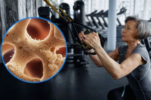 Как да не губим костна плътност с 5 упражнения