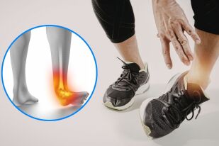 Защо продължавам да си навяхвам глезена и кога става хронично състояние