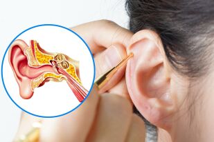 Рак на ухото: Може ли да се лекува рядкото заболяване