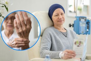 Периферна невропатия след химиотерапия: Най-добрите средства за лечение