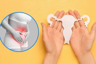 6 мита за ендометриозата: Какво казват специалистите?