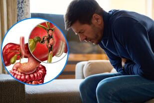 Какво причинява запушване на жлъчните пътища?