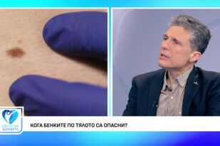 Рискови фактори за появата на кожен меланом