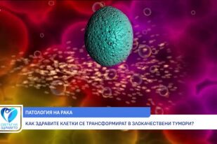 Снимка Канцерогенеза: Как стартира едно онкологично заболяване? (ВИДЕО)