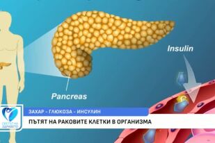 Как консумацията на захар подпомага развитието на ракови клетки?
