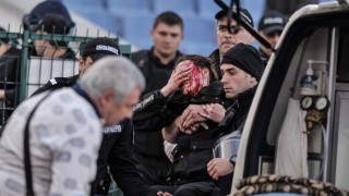 Полицайка с опасност за зрението след бомбичка на ЦСКА - 