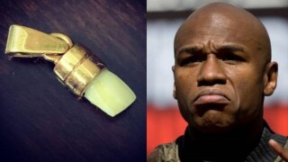 Зъб на Мейуедър се превърна в украшение за негов съперник (ВИДЕО)