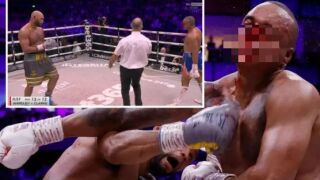 Всичко плувна в кръв: Боксьор оцеля 12 рунда със счупен нос (СНИМКИ и ВИДЕО)