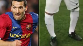 Световен шампион: Лекарите ме показват като експонат. Чудят се как ходя