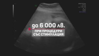 Снимка: „Съпругът ми вади калкулатора, когато тестът е отрицателен“: Двойки плащат сами за шанс за дете
