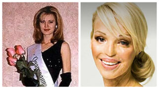 Отхвърлен ухажор залива с киселина лицето на една кралица на красотата – как живее тя 20 г. по-късно