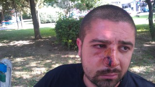 Пострадал при мелето в Пазарджик: Полицаите седяха и гледаха (ВИДЕО)