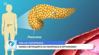 Снимка Какви са постиженията в лечението на рака на панкреаса?      