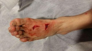 Лихтщайнер обезобрази крака на футболист на 