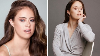 Гимнастичка със синдром на Даун разчупи модните стереотипи (ВИДЕО)