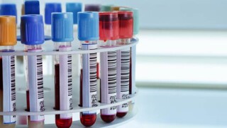 Коронавирусът спря и работата на антидопинговата агенция