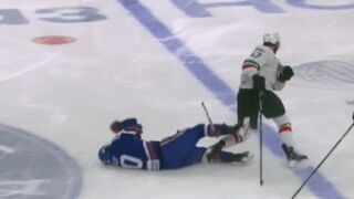 Хокеист остана без цял ред зъби след сблъсък с противник (СНИМКА)