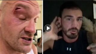 Разбили лицето на Тайсън Фюри заради глупава шега (ВИДЕО)