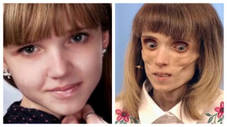 „Животът е един“: Историята на Кристина, която стига до 17 килограма в стремеж към „съвършенство“