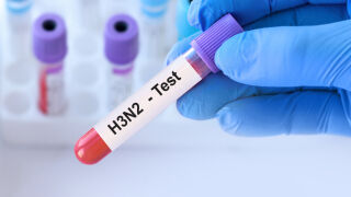 Снимка: Две области са в грипна епидемия – Варна и Добрич, Бургас е на прага на епидемия