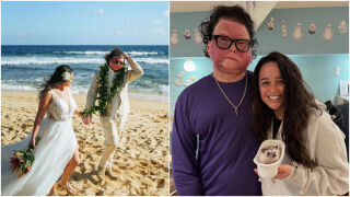 Тиктокър с първа трансплантация на лице и ръце открива любовта: Нов живот след 80% изгаряния (СНИМКИ)