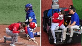 Топка, летяща със 150 км/ч, обезобрази бейзболист (ВИДЕО)