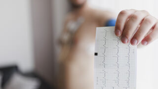 Снимка: В Световния ден на сърцето: Как да се погрижим за него и кои са рисковите фактори?