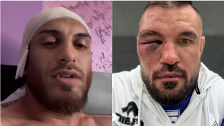 Митко Илиев с отхапано ухо и спукана кост след MAX FIGHT 62 (ВИДЕО)