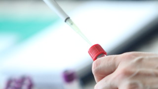 Още двама с COVID-19 в клубовете от Висшата лига