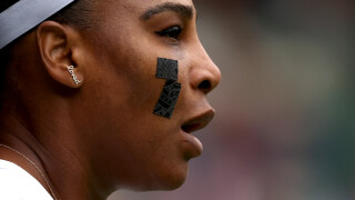 Какви са тези лепенки на лицето на Серина? 