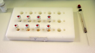 Разследват над 21 атлети за кръвен допинг