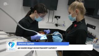 Снимка Орално здраве: До какво води нелекуваният кариес?        
