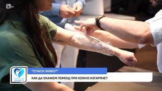 Снимка Как да окажем помощ при кожно изгаряне?        