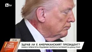 Снимка: Здрав ли е Доналд Тръмп?
