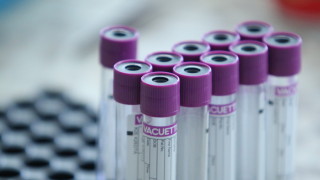 Още двама с COVID-19 във английската Висша лига