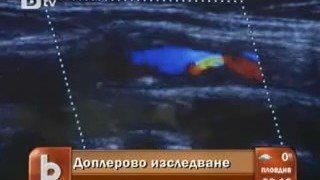 Знаете ли какво е доплерово изследване?