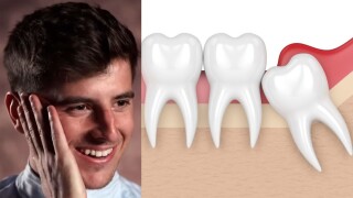 Маунт след зъболекар: Чувствам се получовек-полуакула (ВИДЕО)