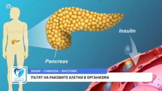 Снимка Как консумацията на захар подпомага развитието на ракови клетки?      